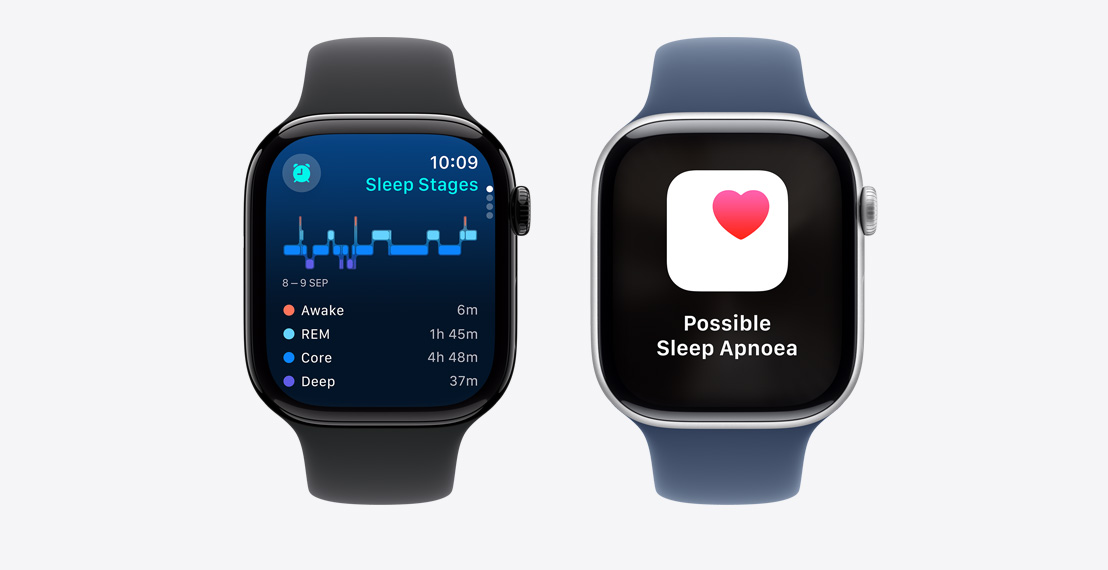 Two Apple Watch Series 10. The first shows Sleep Stages data. The second shows a Possible Sleep Apnoea notification